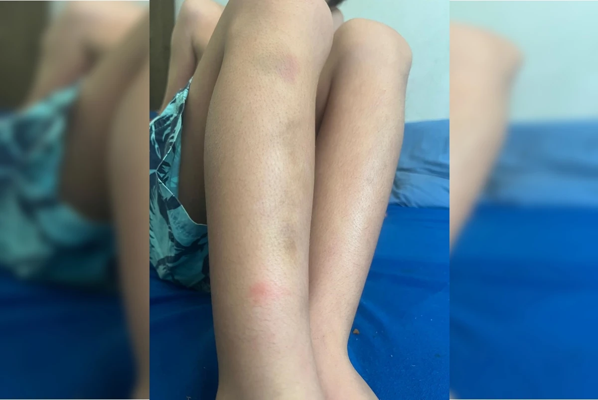 Filho de publicitário preso e agredido por agentes ficou com hematomas