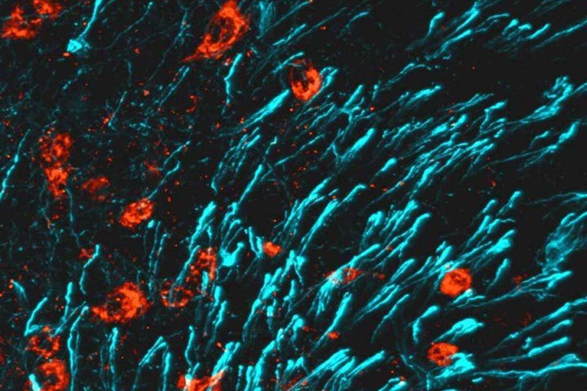 Cientistas descobrem novo hormônio que estimula o fortalecimento ósseo