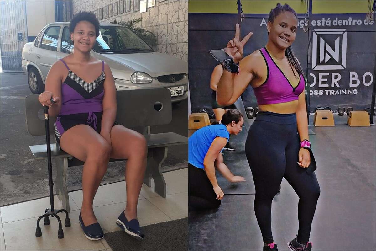 Um ano e meio após AVC, jovem para de usar fraldas e entra no crossfit