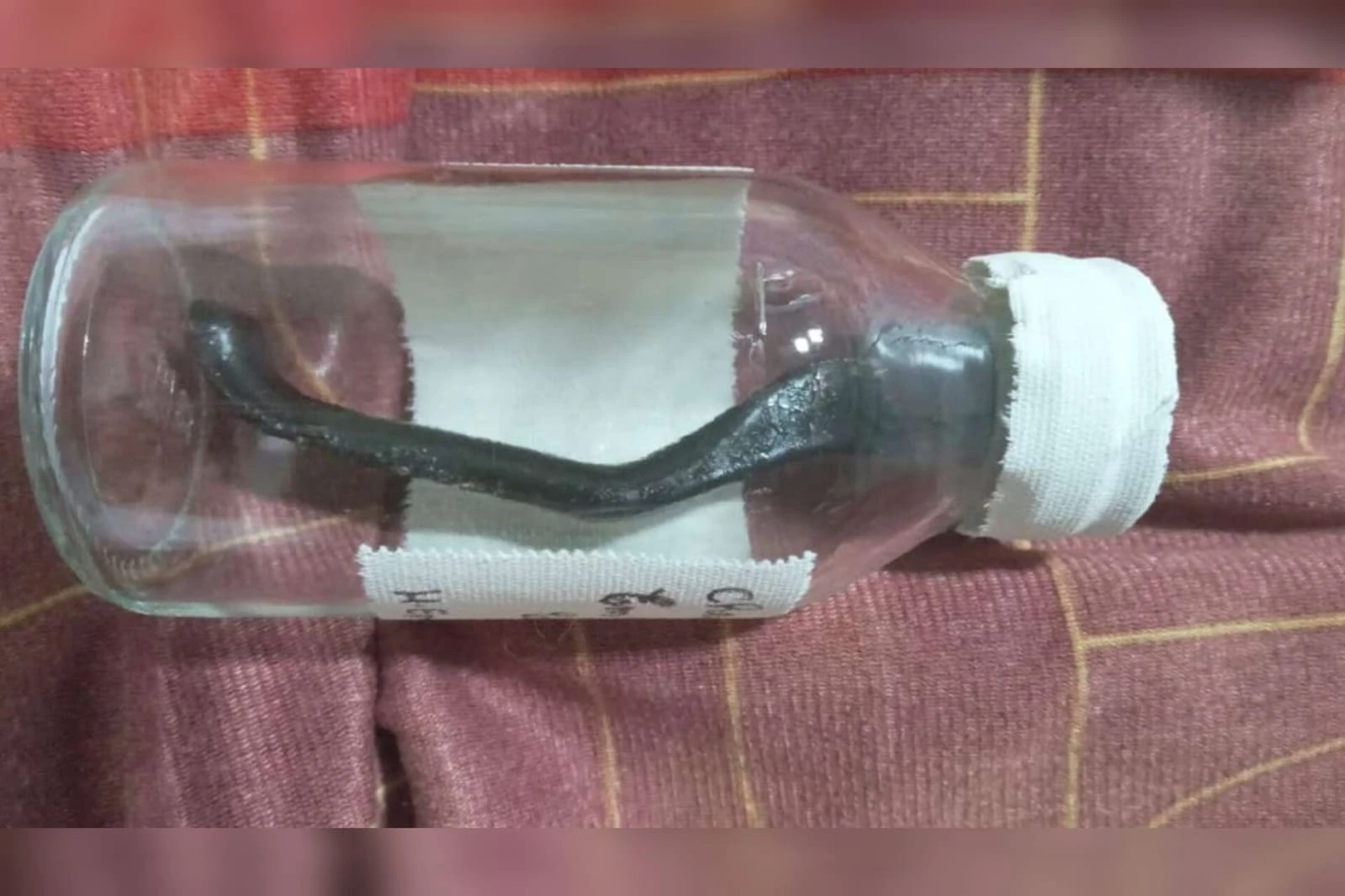 Ciclista atropelado fica 9 meses com peça de bicicleta na barriga