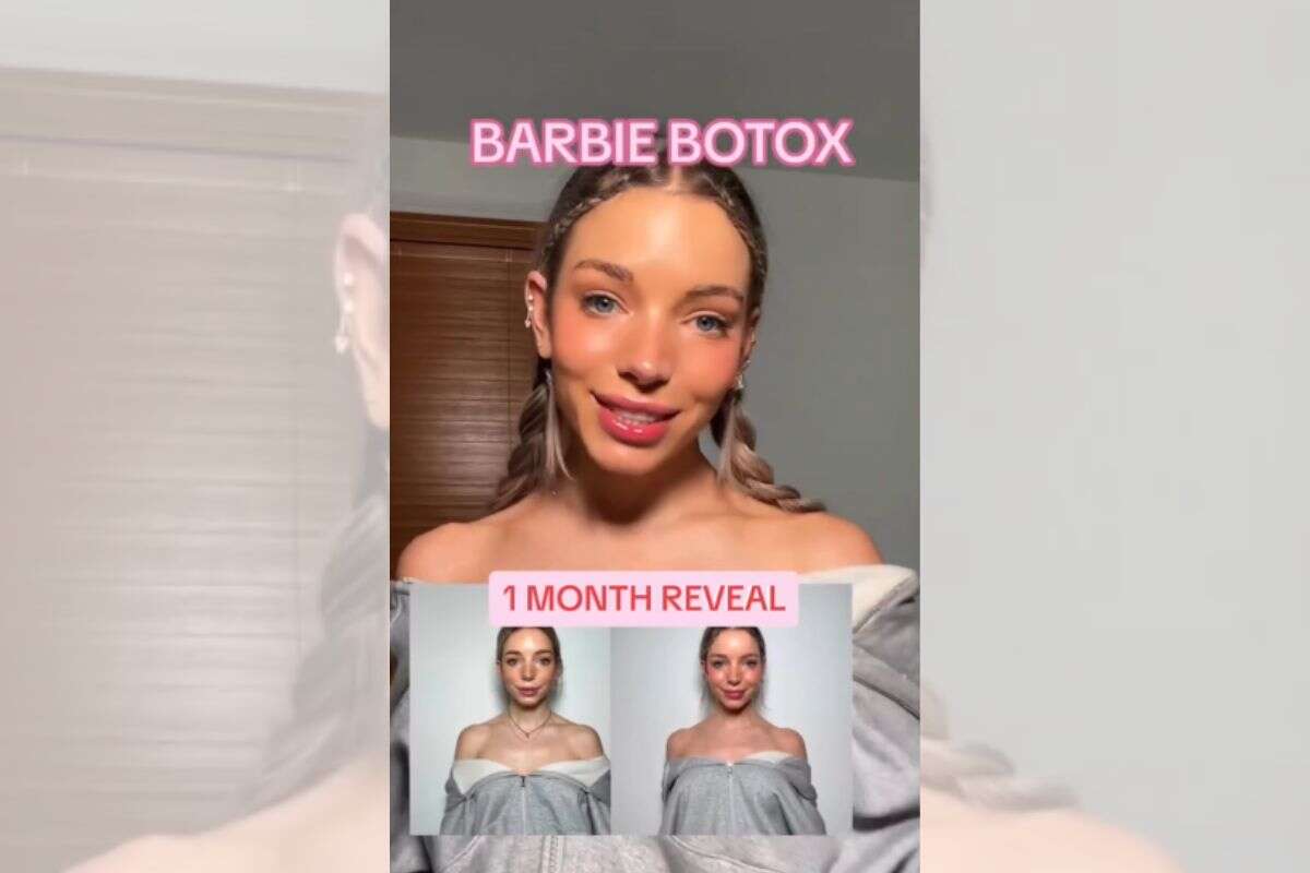 “Botox da Barbie”: entenda procedimento que imita pescoço de boneca