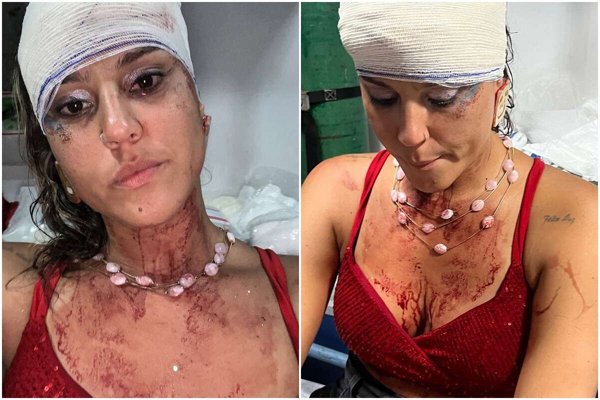 “Apanhei de policiais”: mulher denuncia agressão em bloco de Carnaval