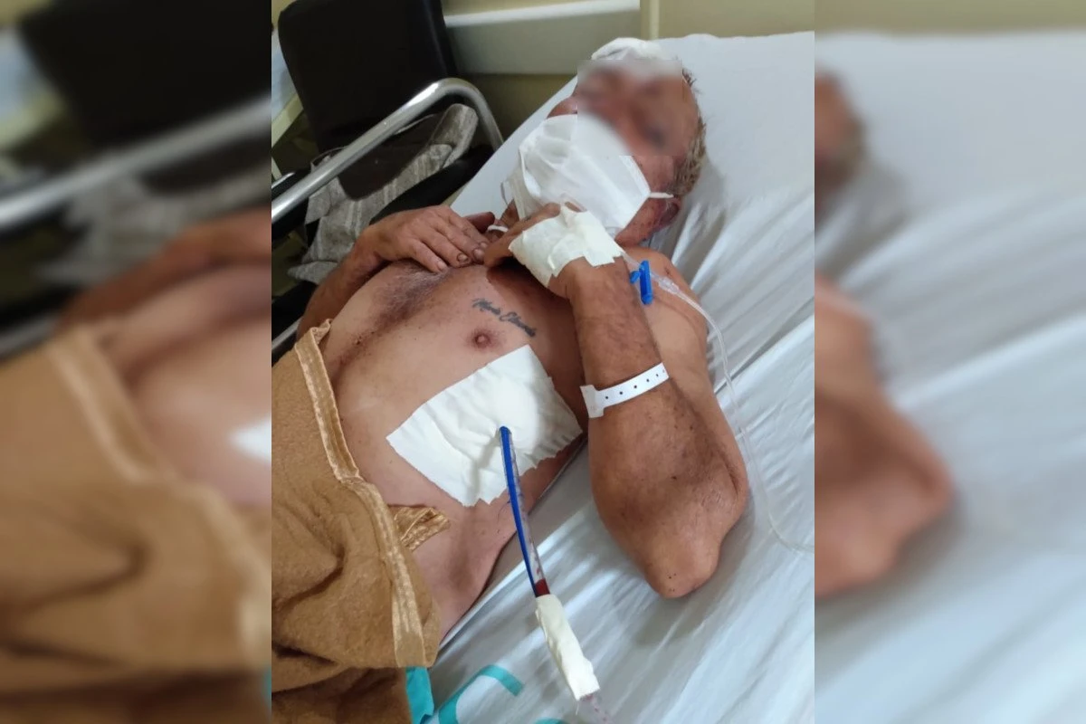 Apaixonado por adolescente, idoso é espancado após sofrer emboscada no DF