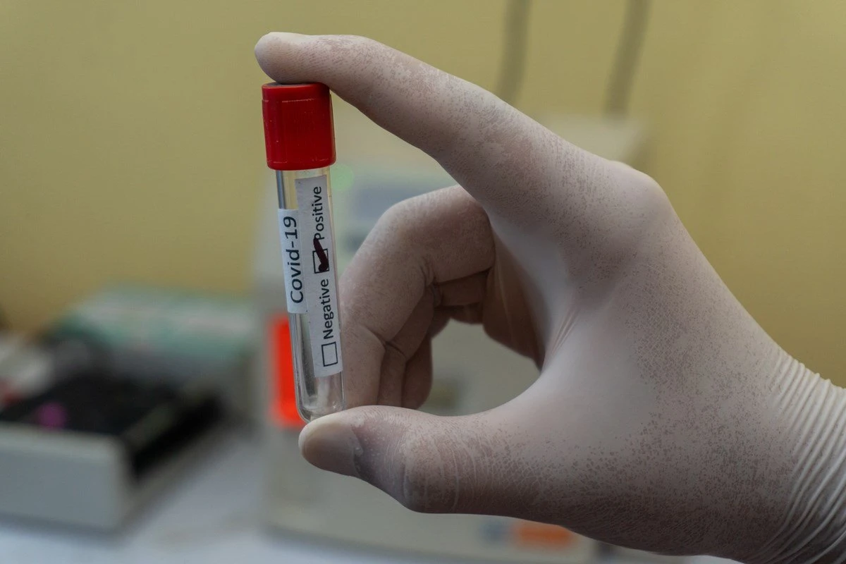 Covid-19: mulher volta do Reino Unido e testa positivo em Sergipe