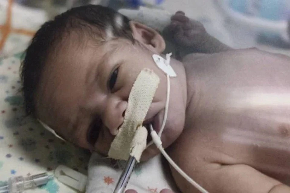 Após um mês de espera, bebê consegue cirurgia cardíaca no DF: “Ele já é um herói”, diz mãe