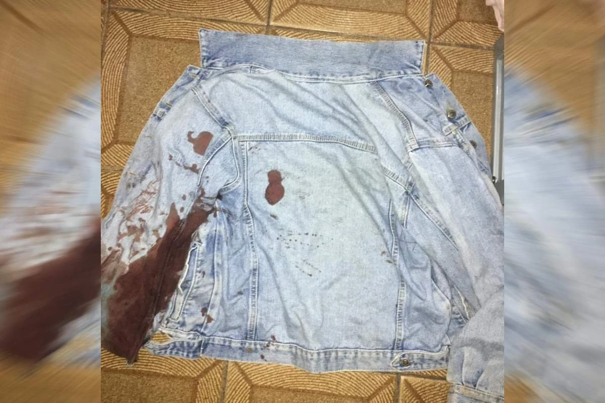 Jovem baleado no Metrô-DF: “Não teve invasão. Foi um tiro sem motivo, pelas costas”