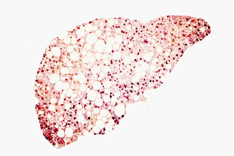 Detox! Conheça oito alimentos para eliminar gordura e toxinas do fígado