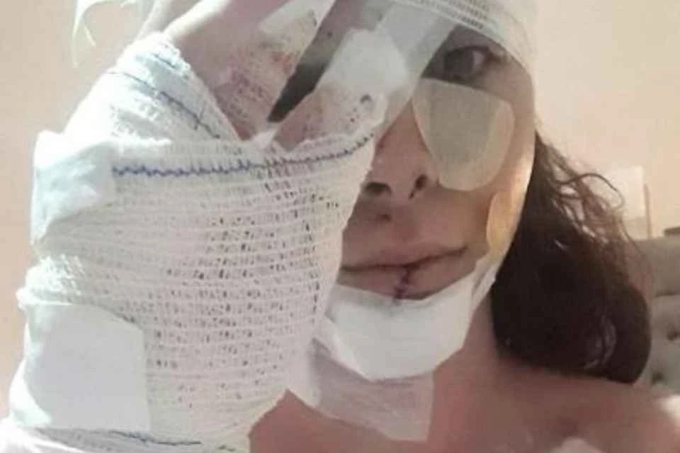 Garota de programa é ferida com mais de 30 facadas por cliente antigo
