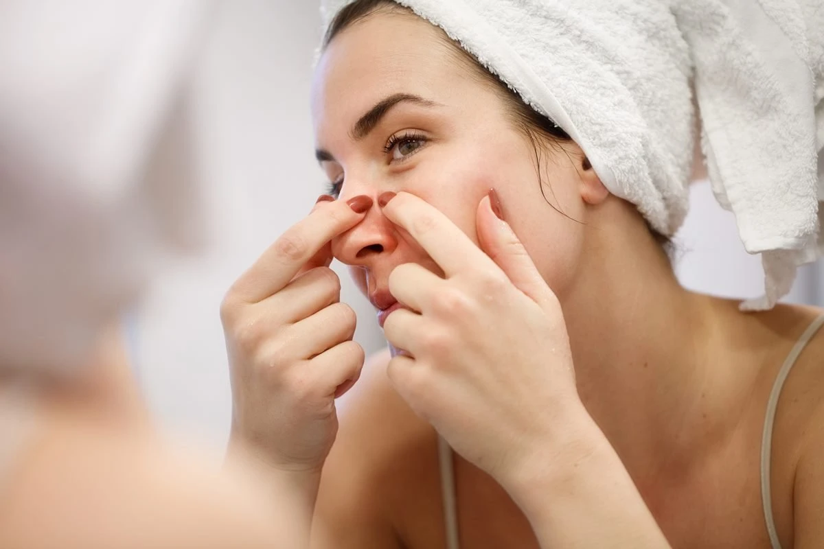 Páscoa: chocolate causa espinhas? Dermatologista explica