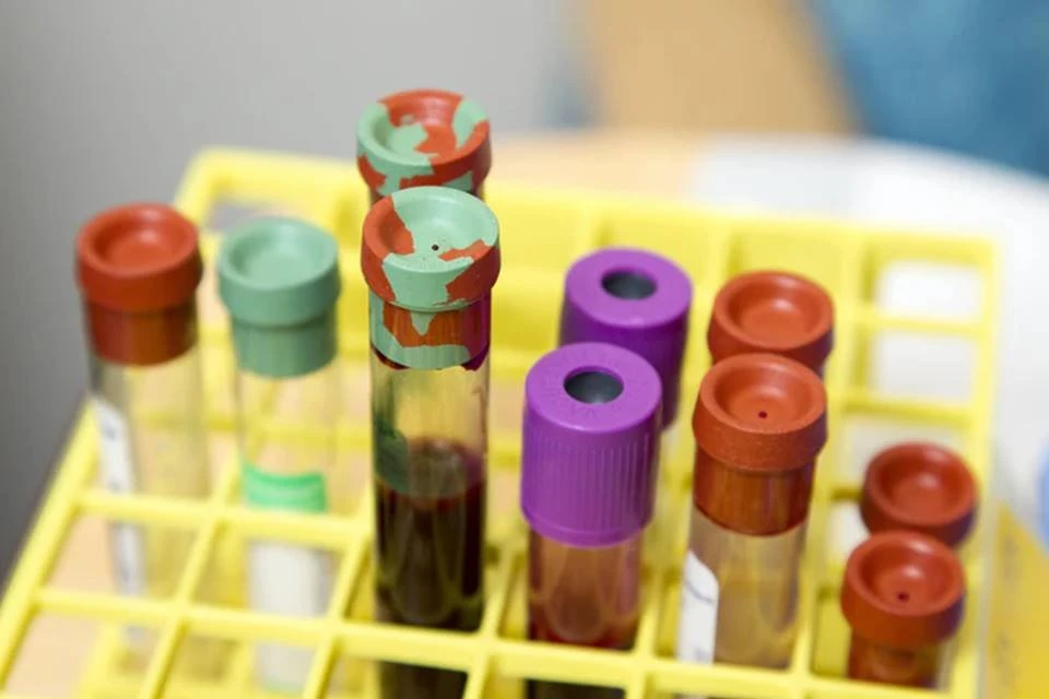 Triglicerídeos: conheça 6 dicas para baixar a gordura no sangue
