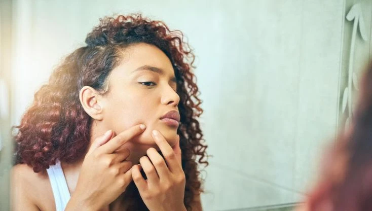 Acne, i cosmetici contro l'effetto rebound da rientro