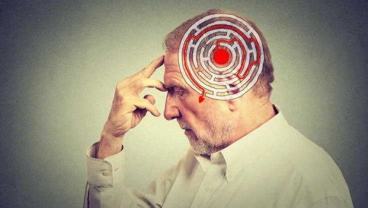 Alzheimer, preservare la memoria con la stimolazione magnetica