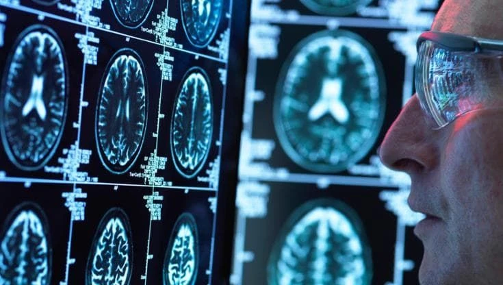 Alzheimer, scoperta un’unica causa dietro la malattia