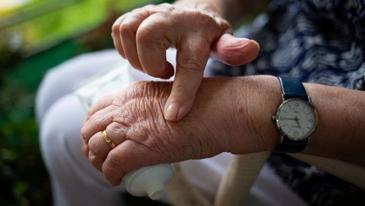 Macchie della pelle: come prevenirle e quando eliminarle