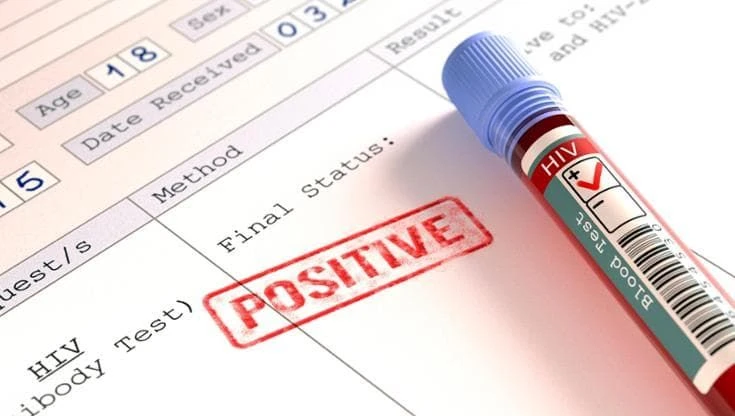 Hiv, l’Ema dà il via libera alla Prep semestrale