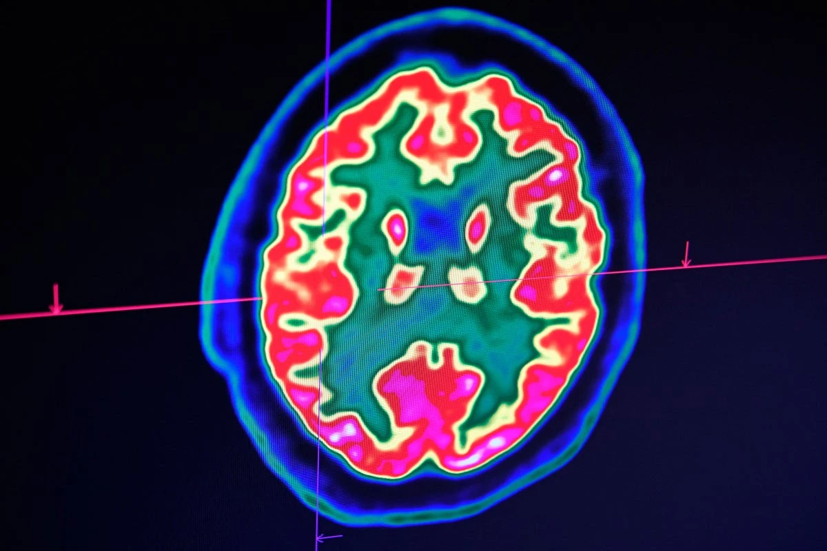 AI sometimes thinks like humans, scientists reveal