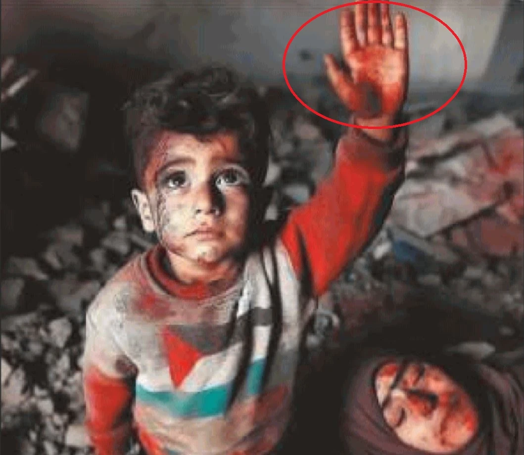 La foto del bimbo palestinese con sei dita: «È generata con l’Intelligenza Artificiale»
