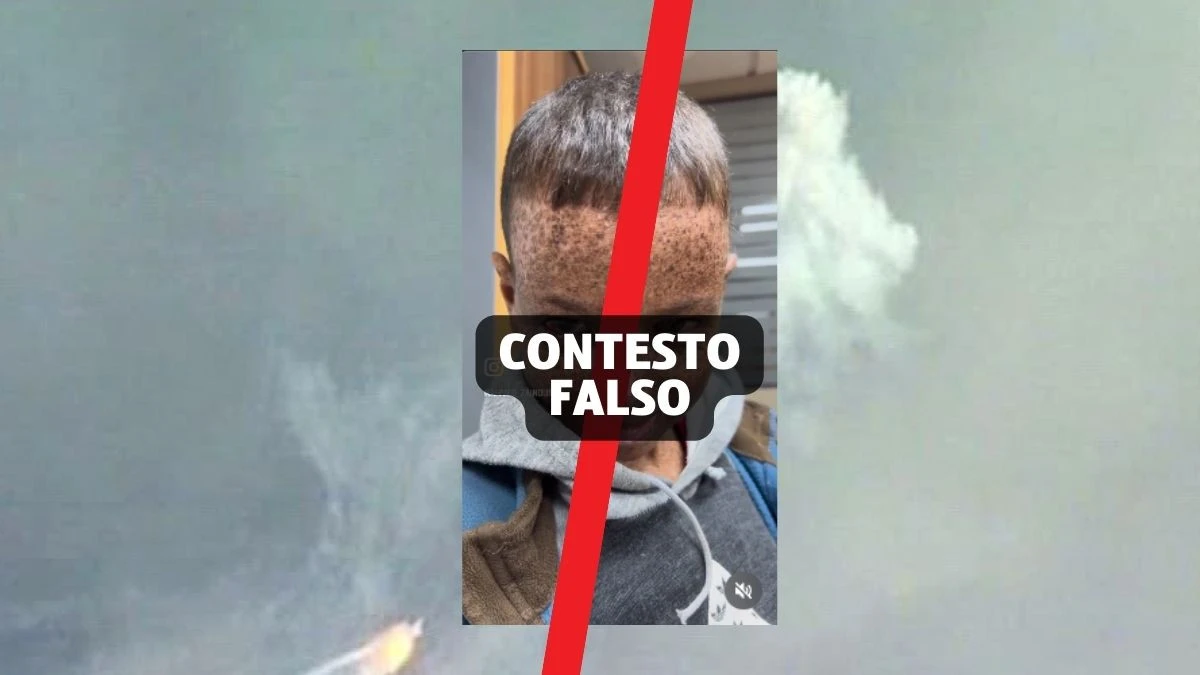 Questo video non mostra un bambino vittima del fosforo bianco a Gaza