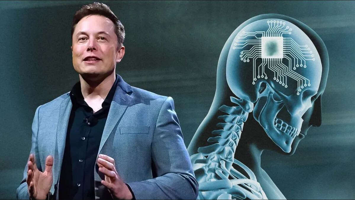 L’annuncio di Musk: Neuralink tornerà a installare microchip nel cervello degli esseri umani