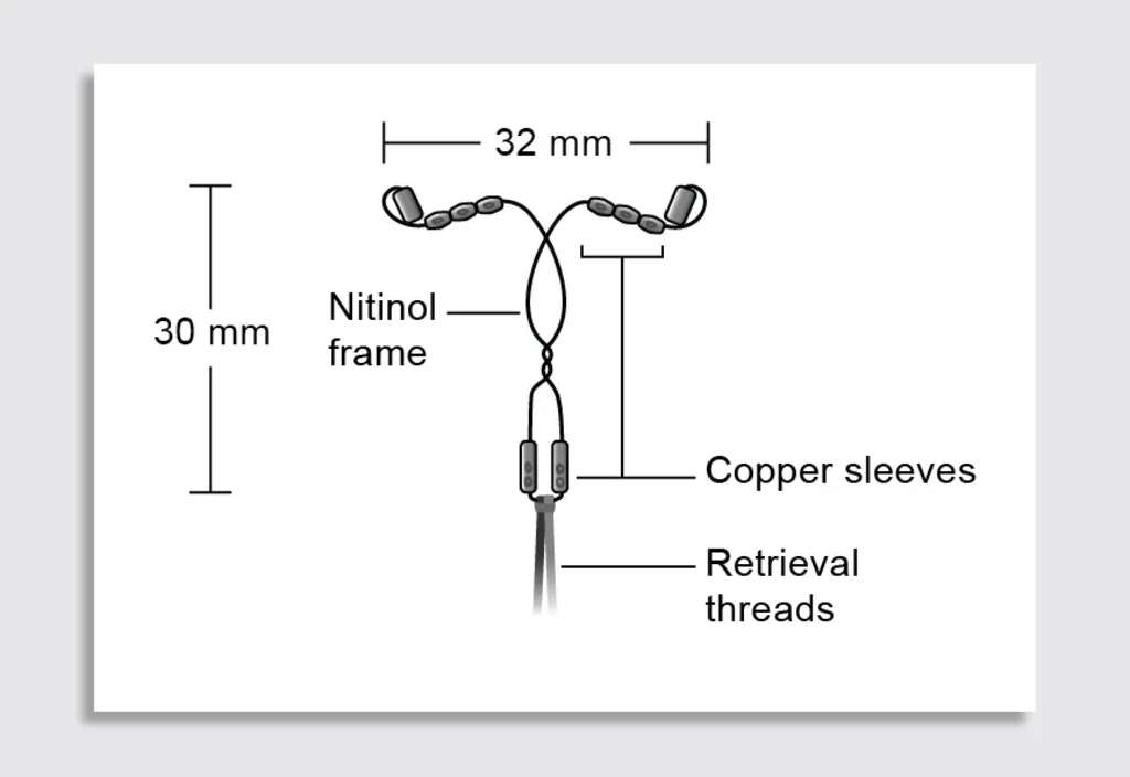 How scientists designed this new copper IUD to be less painful