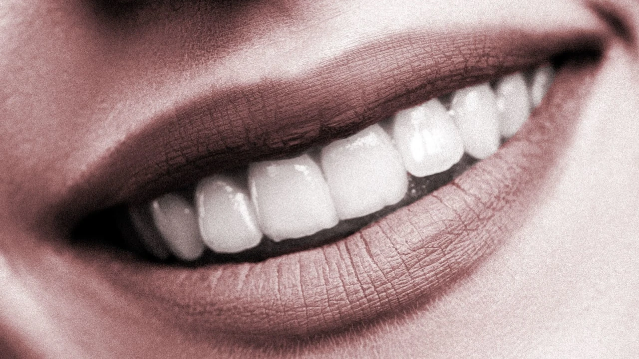 SmileDirectClub says you need to keep making payments on those dental aligners. Do you?