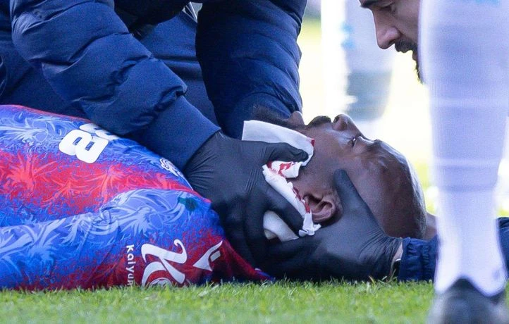 Mateta assure aller « bien » après son très violent choc à la tête