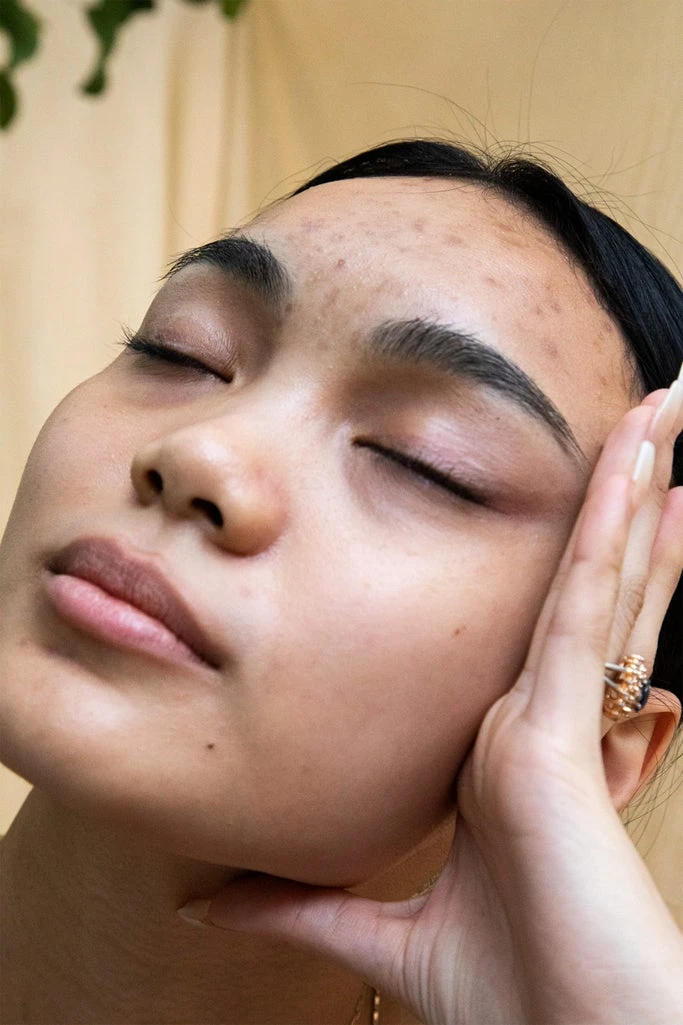 Everything You Need To Know About Hypochlorous Acid, A Summer Skin Hero