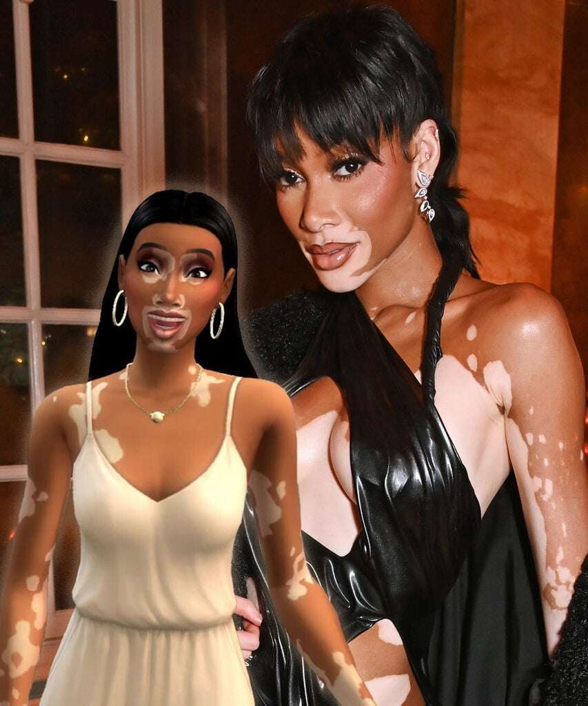 Winnie Harlow’s Vitiligo Sims Skin Is Peak Manifestation Goals