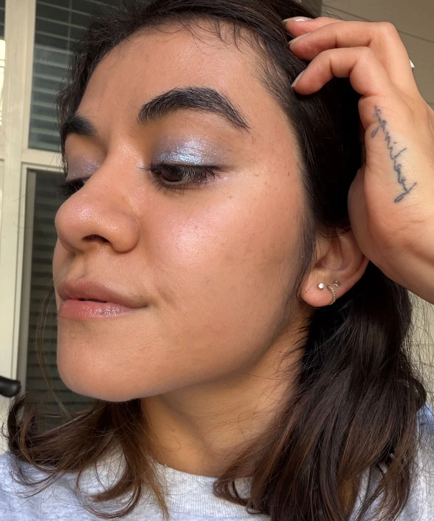 I Thought My Hyperpigmentation Was Acne Scarring — Until A Dermatologist Told Me Otherwise