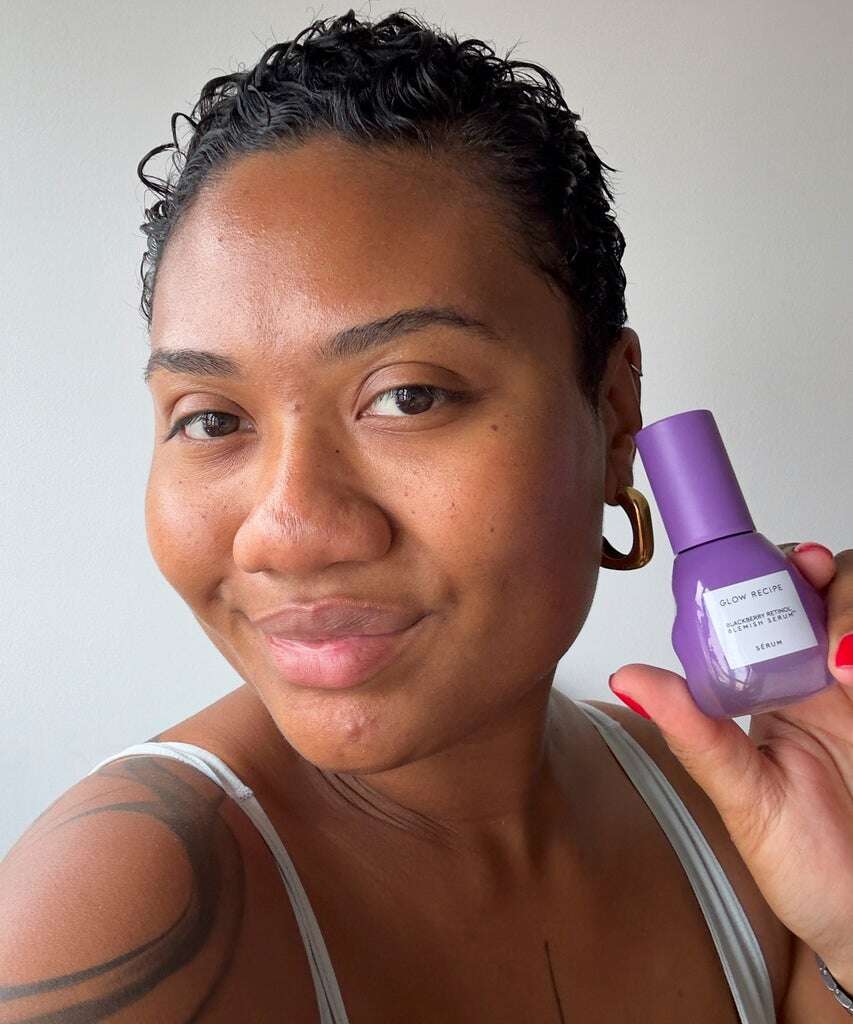 This Retinol Serum Faded My Spots Fast — & It’s Gentle Enough To Use Nightly