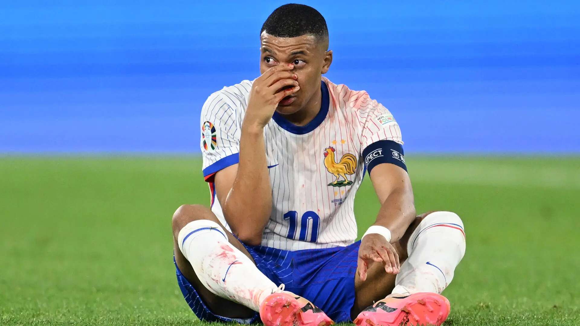 Mbappé, con el rostro ensangrentado: así fue el duro choque que le hizo abandonar el partido