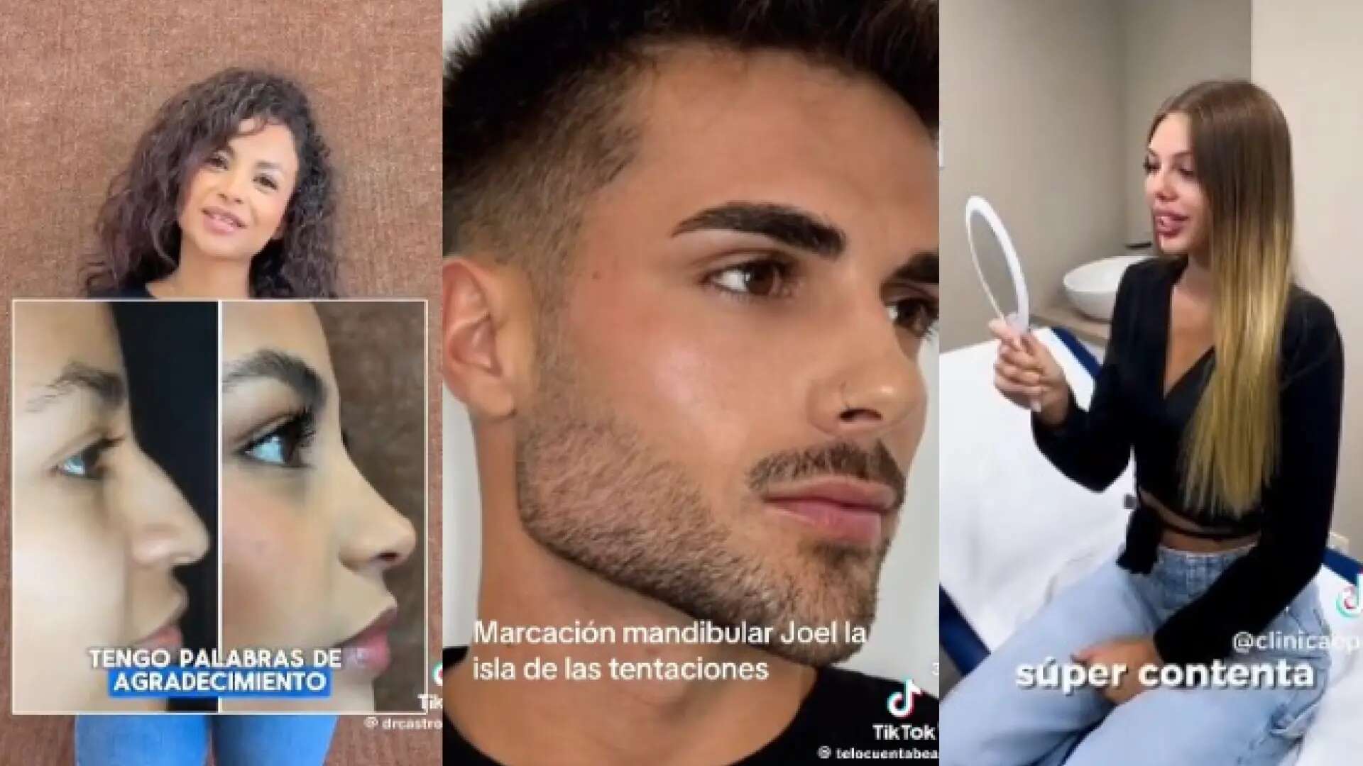 'Las caras, Sandra, las caras': estos son todos los retoques estéticos de los participantes de 'La isla de las tentaciones 8'