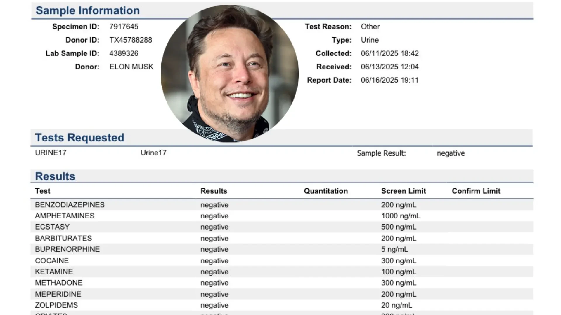 Los esclarecedores resultados del análisis de drogas de Musk: el magnate comparte el informe