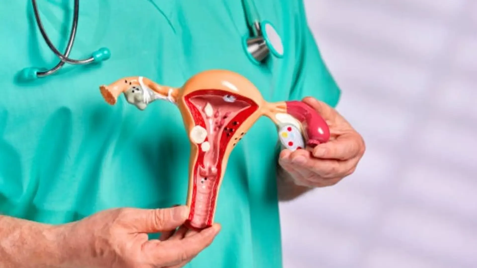 Las afectadas de cáncer de ovario reclaman una atención específica realizada por ginecólogos oncólogos