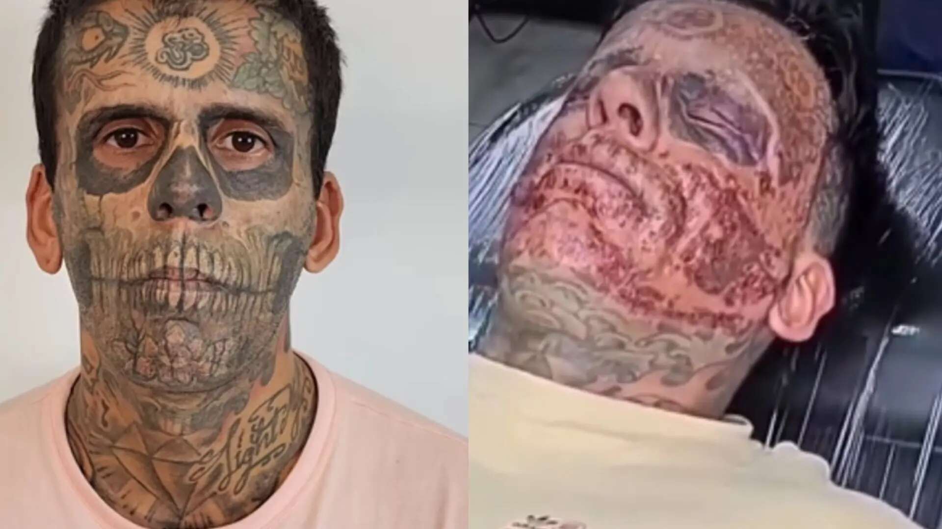 El hombre más tatuado de Brasil se arrepiente y se quita los tatuajes de la cara: 