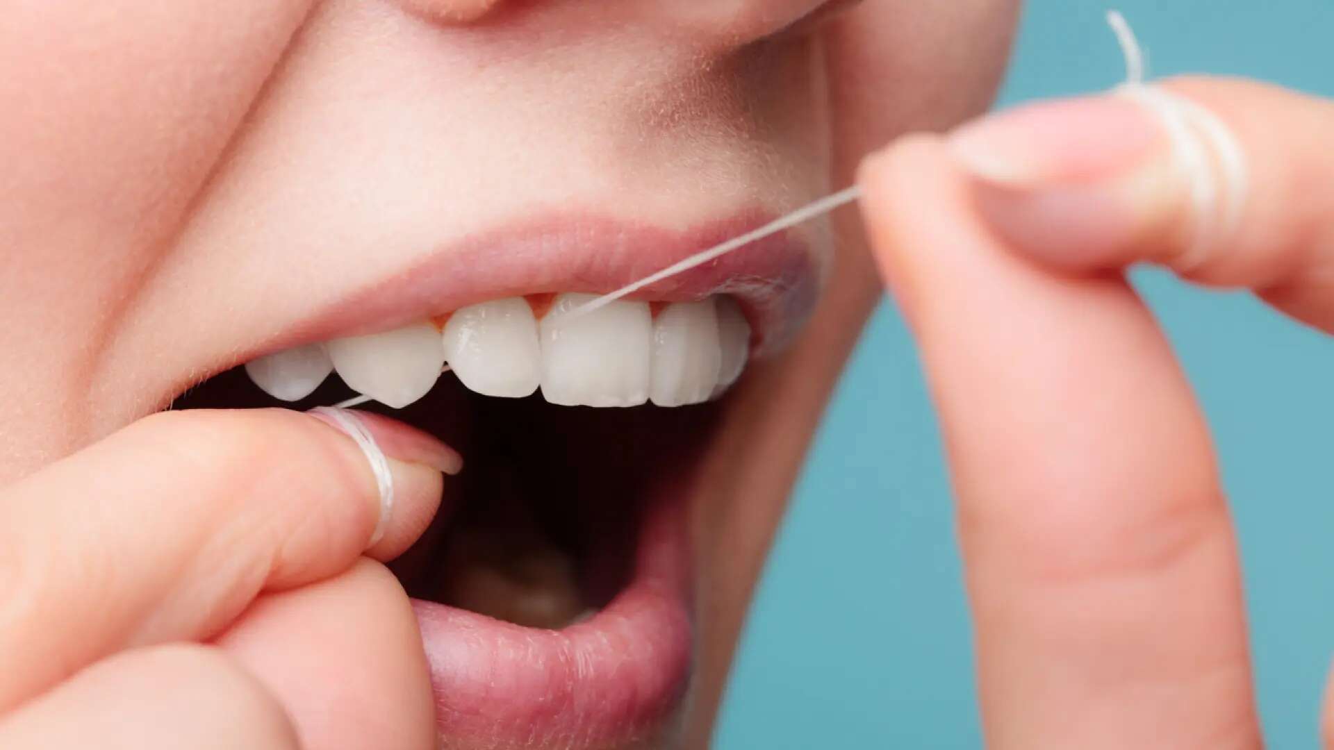 Usar hilo dental habitualmente reduce el riesgo de ictus y de fibrilación atrial, según un nuevo estudio