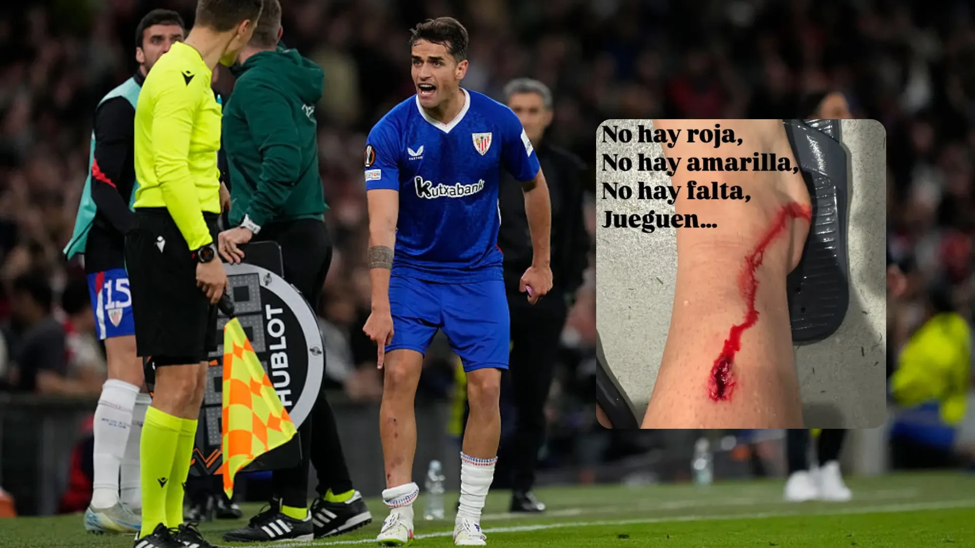 La brutal herida de Prados sufrida ante el United que indigna al Athletic: 