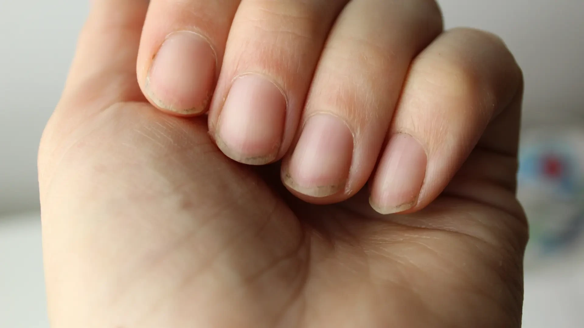 El aspecto de tus uñas te permite saber cuánto vivirás, según Harvard
