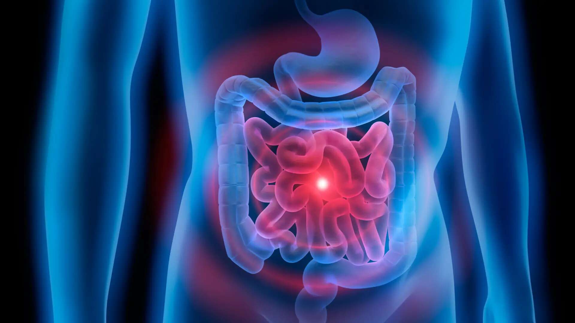 El estudio sobre pacientes jóvenes de cáncer de colon revela cuáles son lostres factores de riesgo