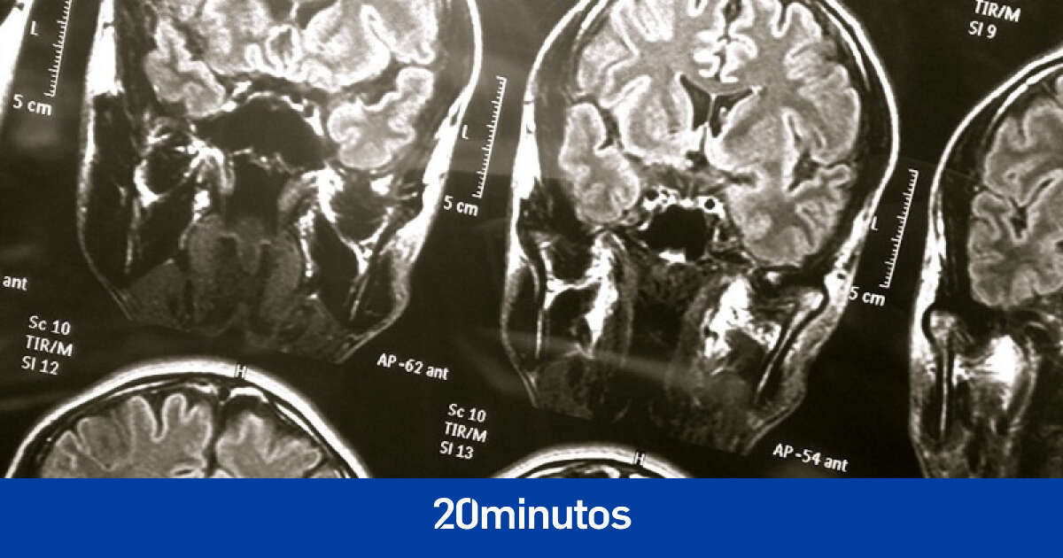 El cerebro tiene más en común con los testículos de lo que crees