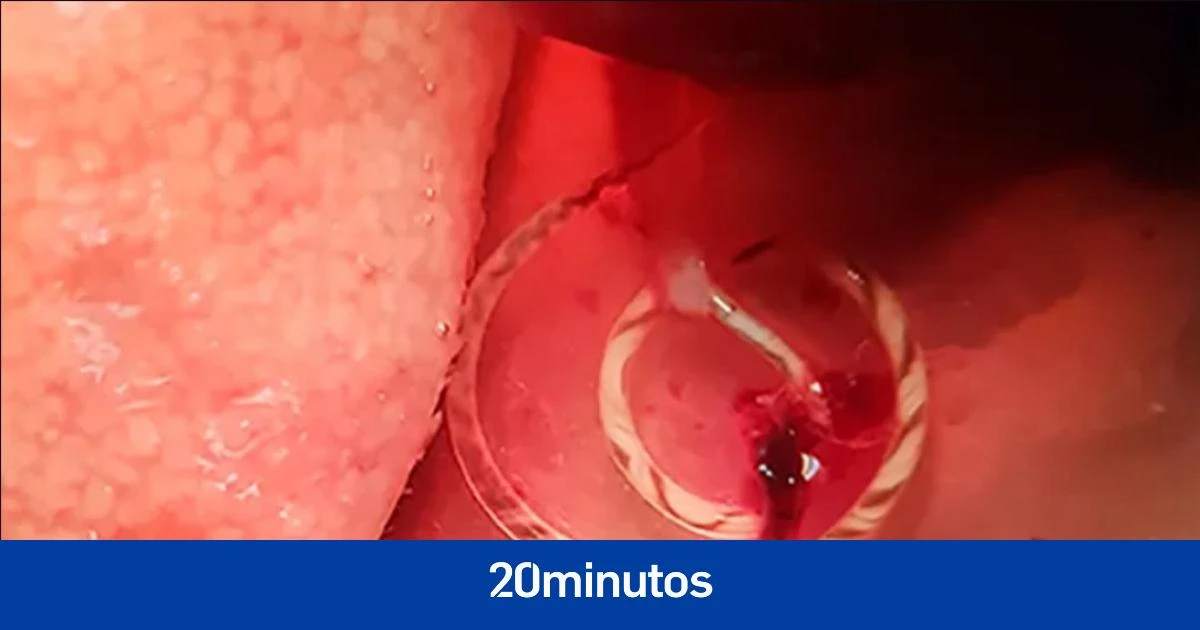 Hallan por primera vez en ratas de las alcantarillas de Valencia un parásito que causa meningitis
