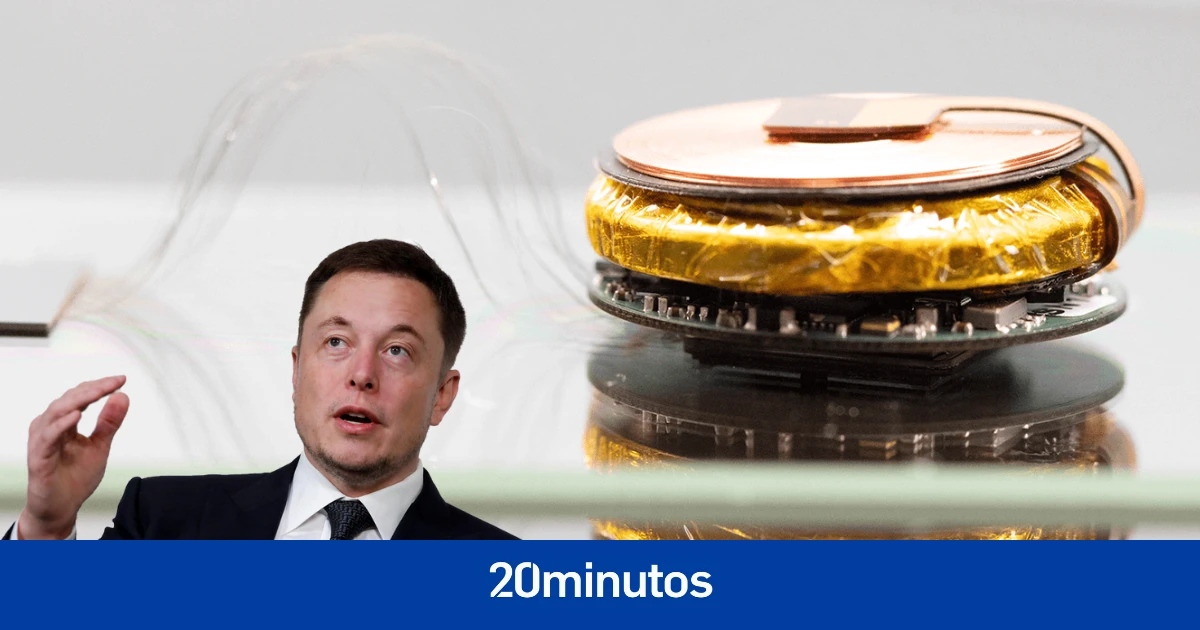 Los experimentos de Elon Musk que han acabado con la vida de 15 monos: 