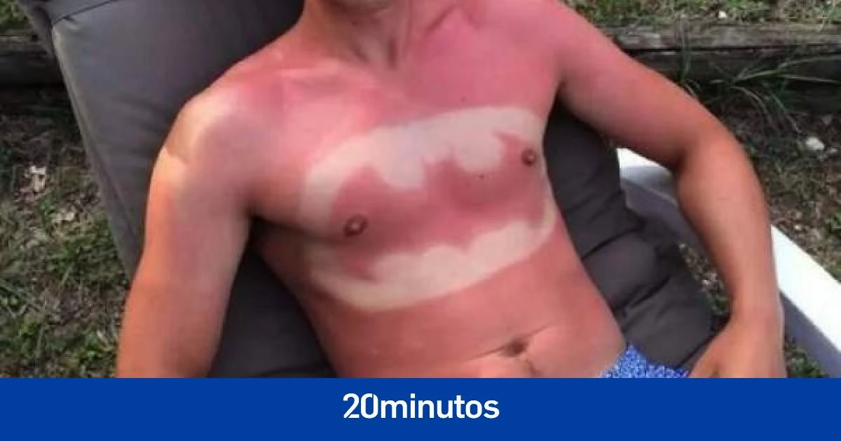 Científicos crean un protector solar que ofrece más protección UV contra las quemaduras solares