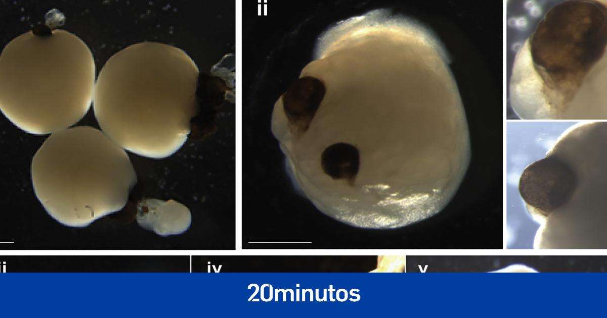 Implantan 'minicerebros' derivados de células humanas a ratas recién nacidas