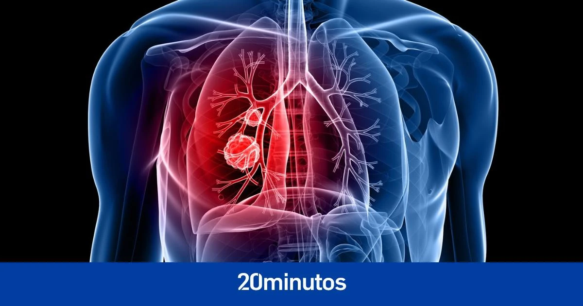 La alta presencia de un gen empeora el pronóstico de los tipos de cáncer más letales