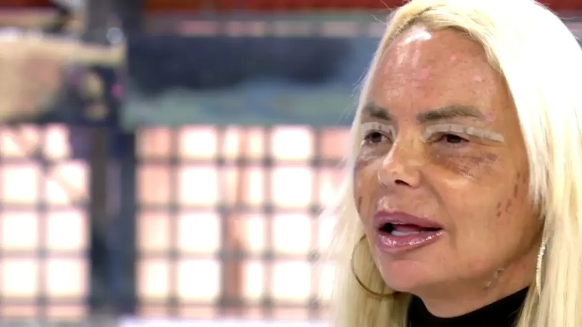 Leticia Sabater muestra su nueva cara tras los retoques estéticos