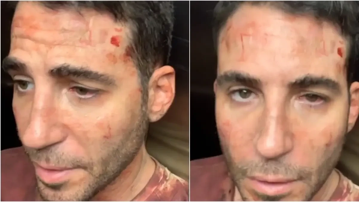 Miguel Ángel Silvestre asusta a sus seguidores con un vídeo en el que aparece lleno de marcas en la cara