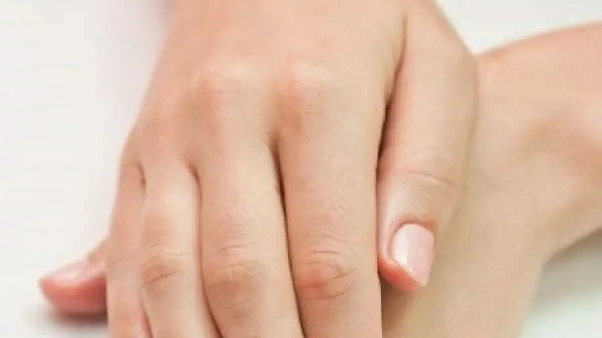 ¿Qué es el síndrome mano-pie? Síntomas, causas y tratamiento