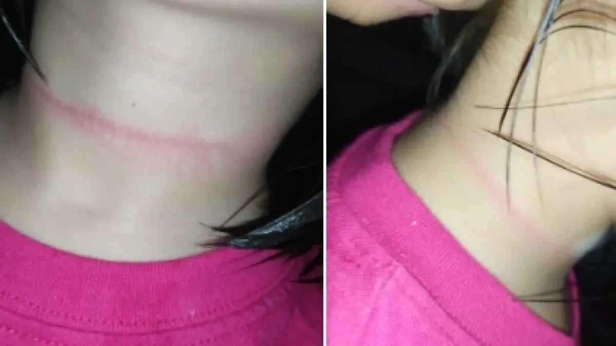 Una mujer salva a su hija de cuatro años de morir ahorcada al imitar un vídeo de TikTok