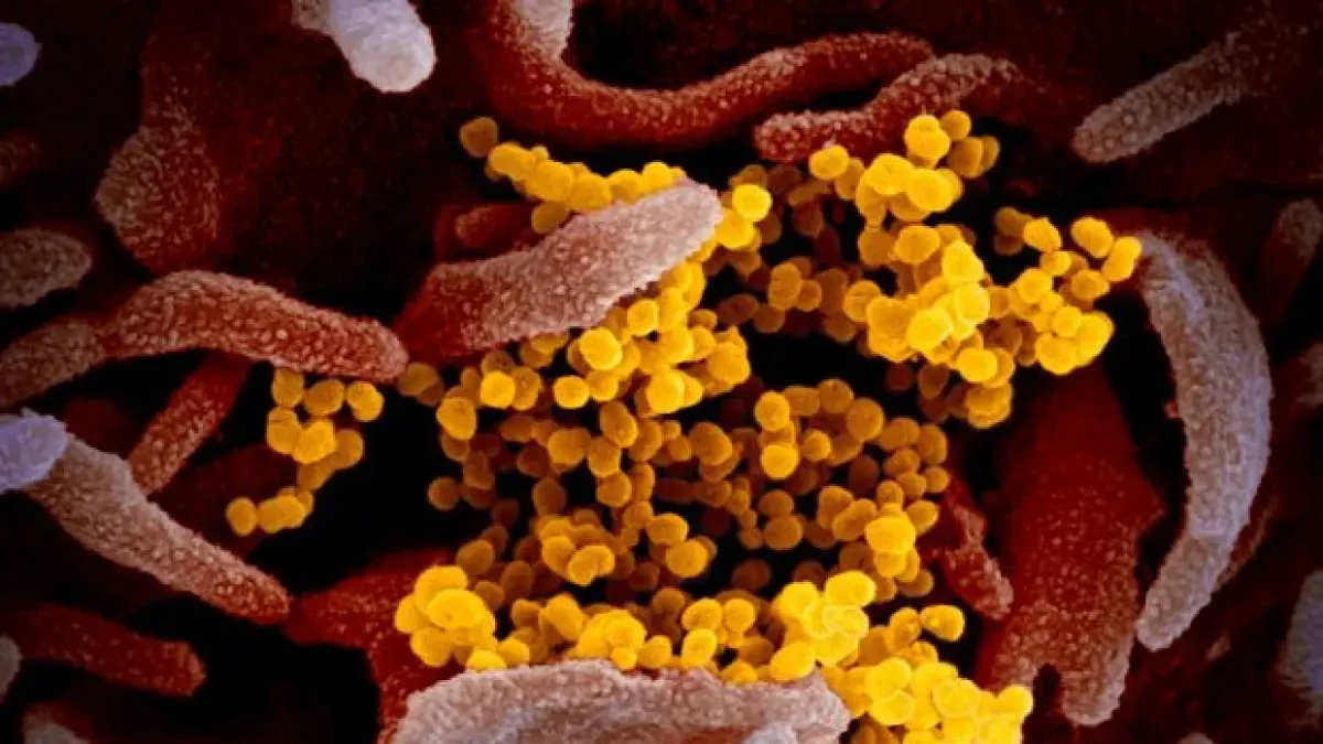 Todo el coronavirus del mundo llenaría poco más de una cucharilla y media de café
